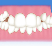歯並びの治療・矯正歯科